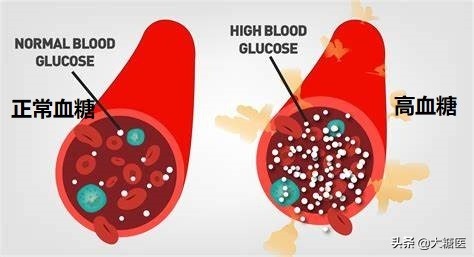 糖尿病人容易觉得疲劳是什么原因,糖友老觉得疲劳该怎么办