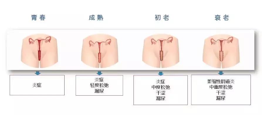 免费“私密分龄检测”帮你搞定私密抗衰第一步