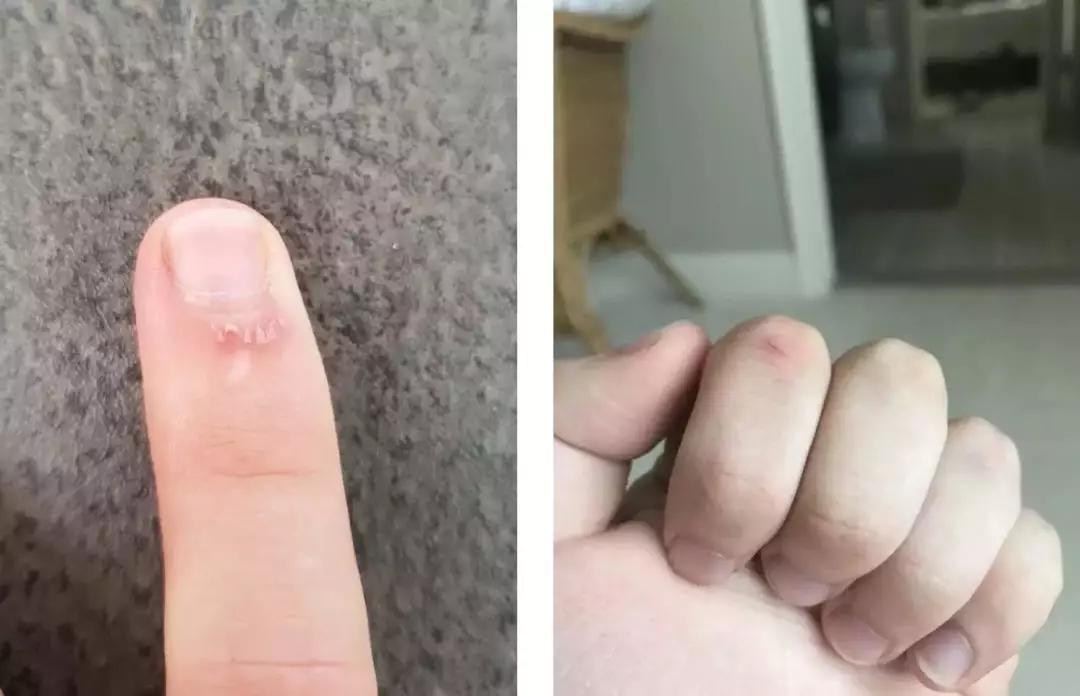 牙套*党**的9个崩溃时刻