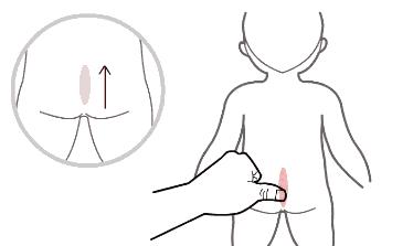 腹泻严重推拿推哪呢,宝宝经常腹泻用什么推拿方法有效