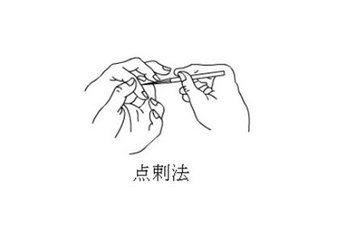 刺血疗法后的注意事项,刺血疗法注意事项及禁忌