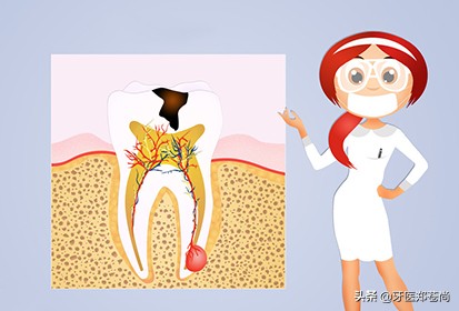 小孩蛀牙疼快速止疼法,蛀牙疼怎么判断是发炎还是神经疼