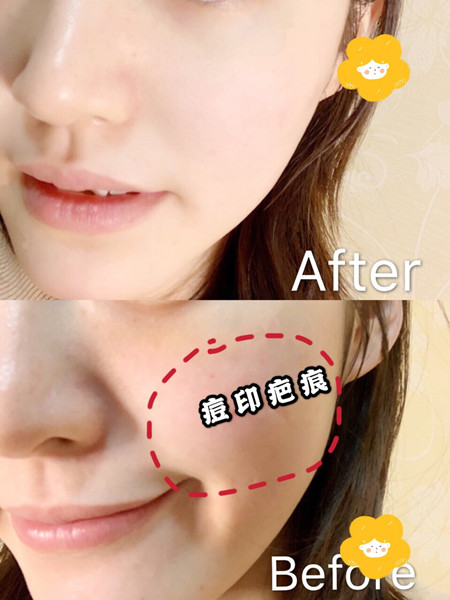 冬天用甘油好还是凡士林好，冬季要不要单纯使用甘油？