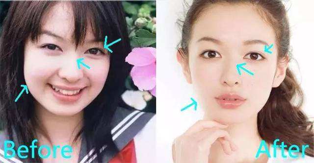 韩式整容怎么样,韩式整形对比