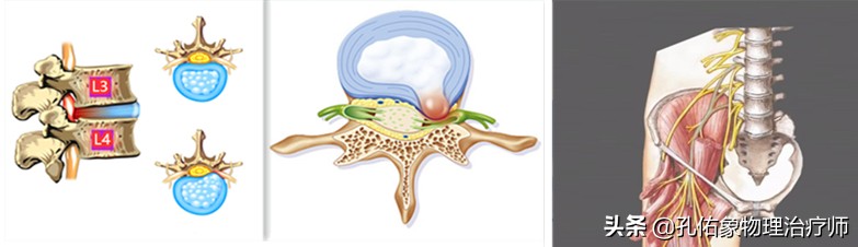 女大腿根内侧疼痛是什么原因,女性左大腿内侧根部疼是怎么回事