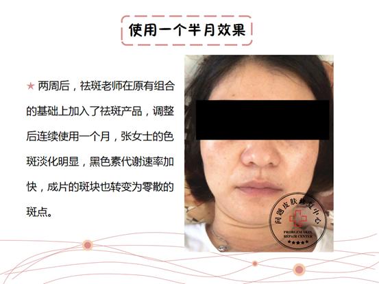 st皮肤问题修复中心,st皮肤修复中心在哪里