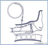 干货：气管切开术及护理措施