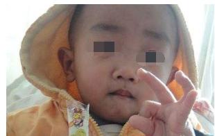 宝宝吃蓝莓卡喉父亲施救后续,小孩吞弹珠抢救视频