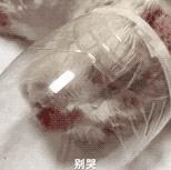 “割声带、截肢、电击,当爱变成我的噩梦”