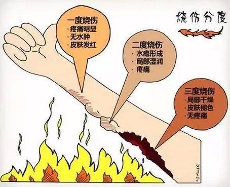 法国优格医疗用品图文,法国优格伤口敷料