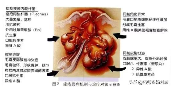 疮疡病的克星,清创宝典