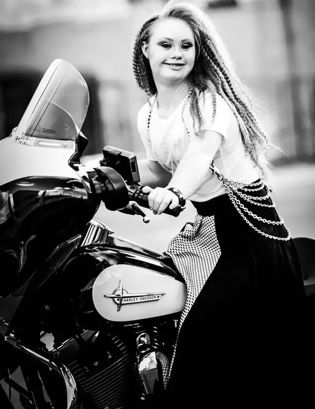 唐氏综合征中国美女,患有唐氏综合征的维密模特