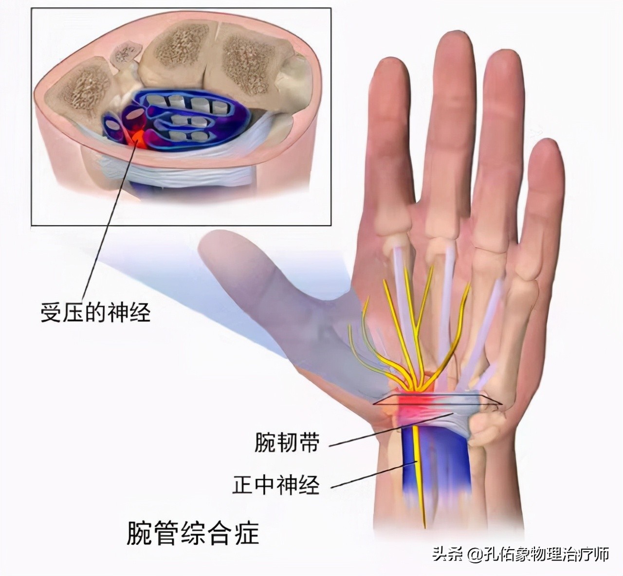 左手麻肩胛骨疼痛是怎么回事,手麻肩胛骨痛