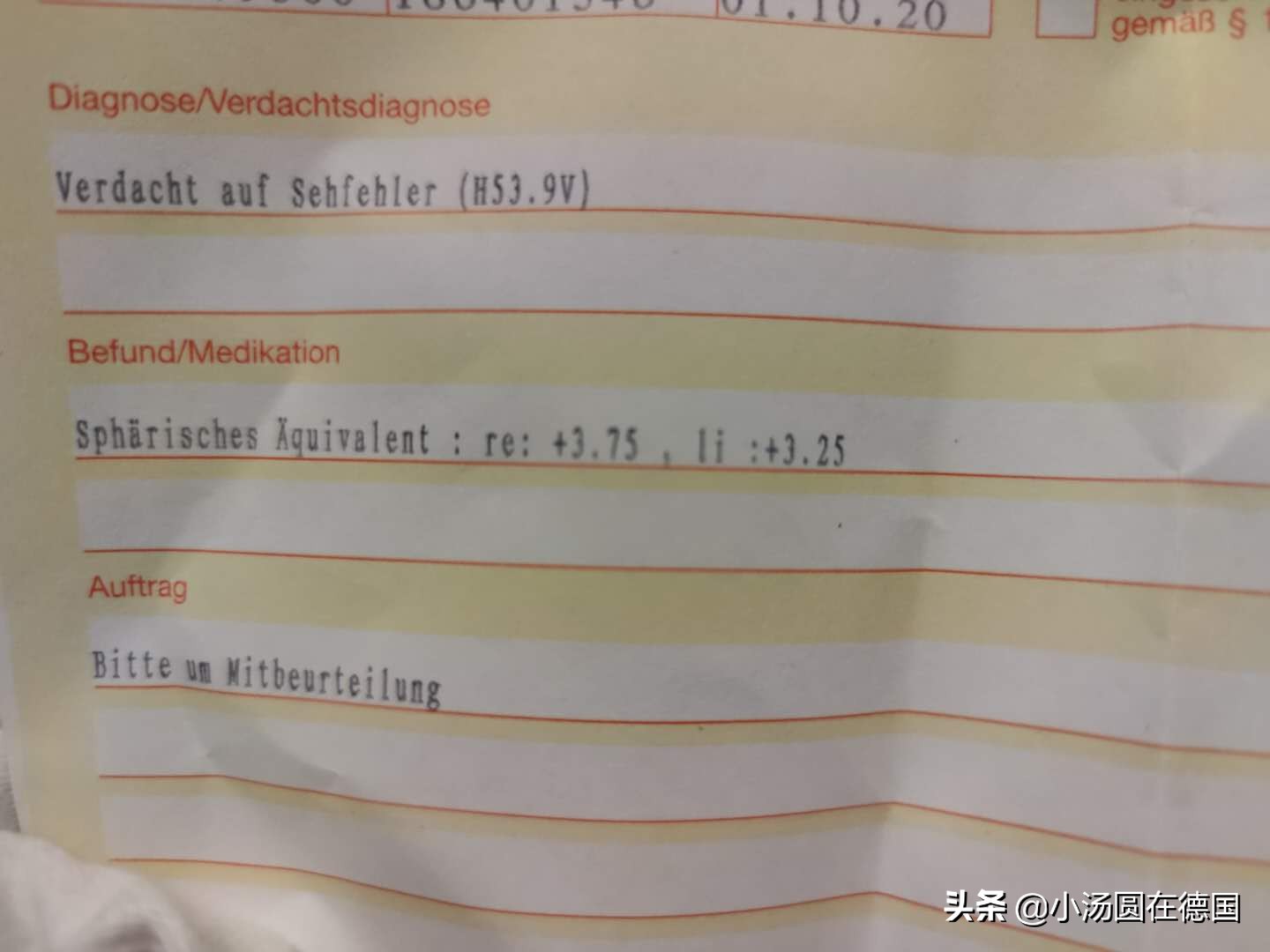弱视检查,6月龄宝宝就可做,千万别忽视3岁前干预的关键期