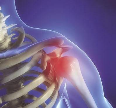 肩周炎五十肩最快的恢复办法,五十肩周炎怎么锻炼