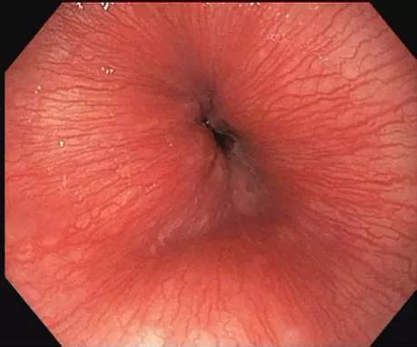体检最难受的项目是哪几个,体检十大问题及解决方法