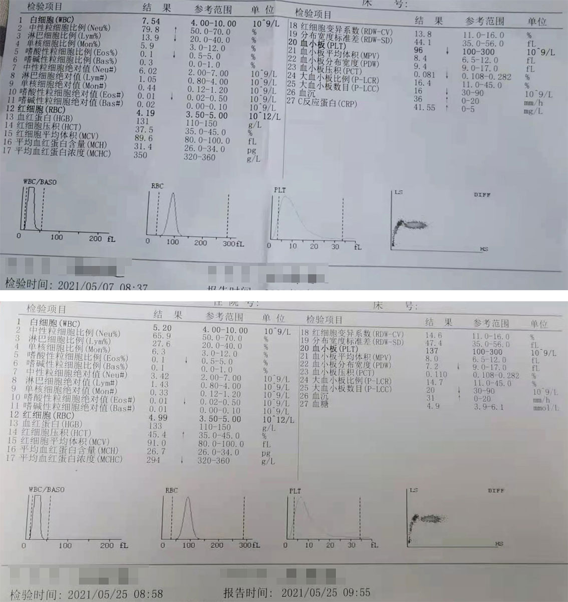京城老中医张东明辨证遣方治疗红斑狼疮引起的高热效如桴鼓