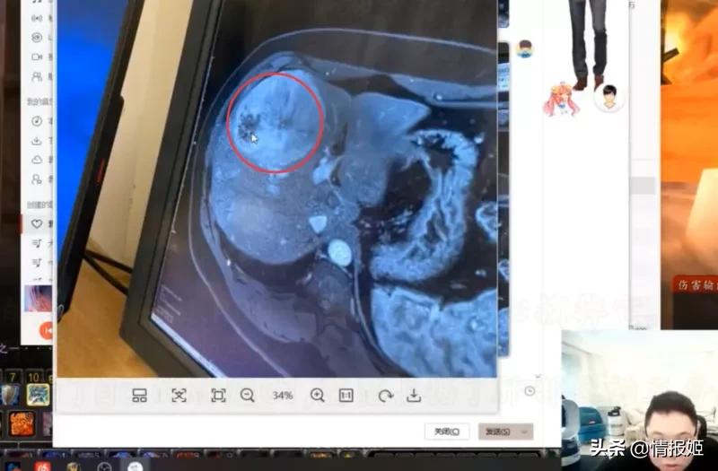 网瘾杨永信,杨永信以雷霆击碎网瘾