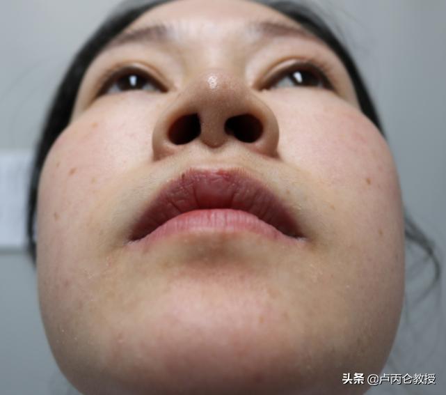 整形会有后遗症吗?为什么整形会上瘾