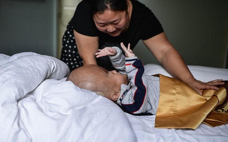 毒奶粉大头娃娃现状,毒奶粉大头娃娃现在怎么样