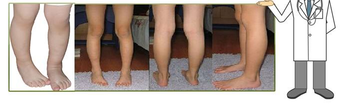 专家教你如何选鞋子,儿童选什么样的鞋对脚型好