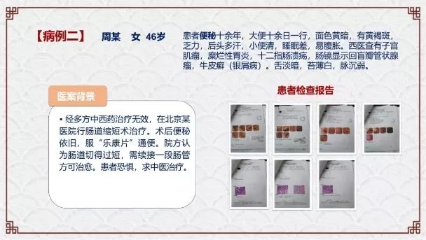 肿瘤与糖尿病的区别,糖尿病与癌症之间回顾性分析