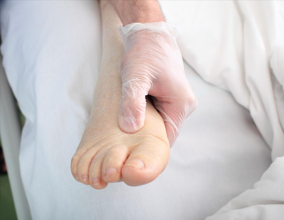 血肌酐超过100需要治疗吗,血肌酐100至120之间浮动