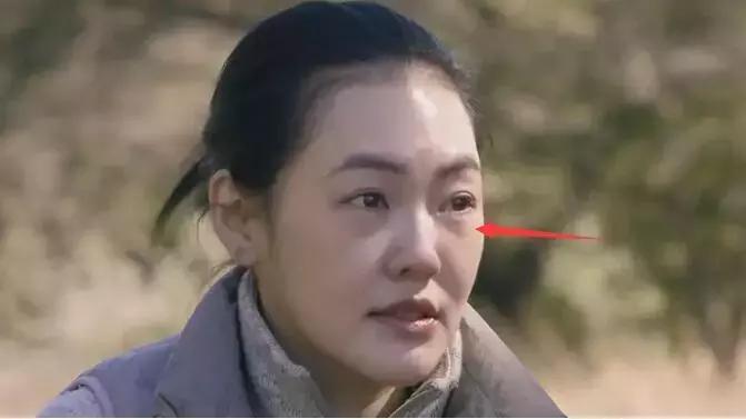 眼袋怎么消除简单方法男生,黑眼袋怎么消除最快方法男士