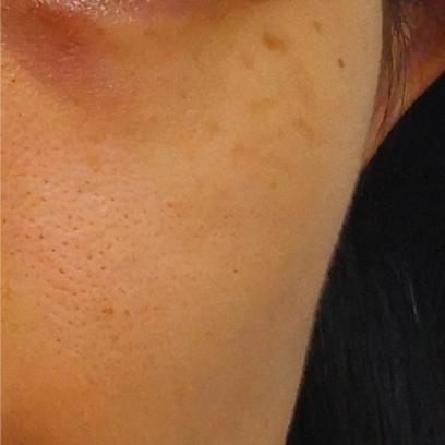 科颜氏抗初老精华露元气弹,科颜氏小白瓶跟元气弹