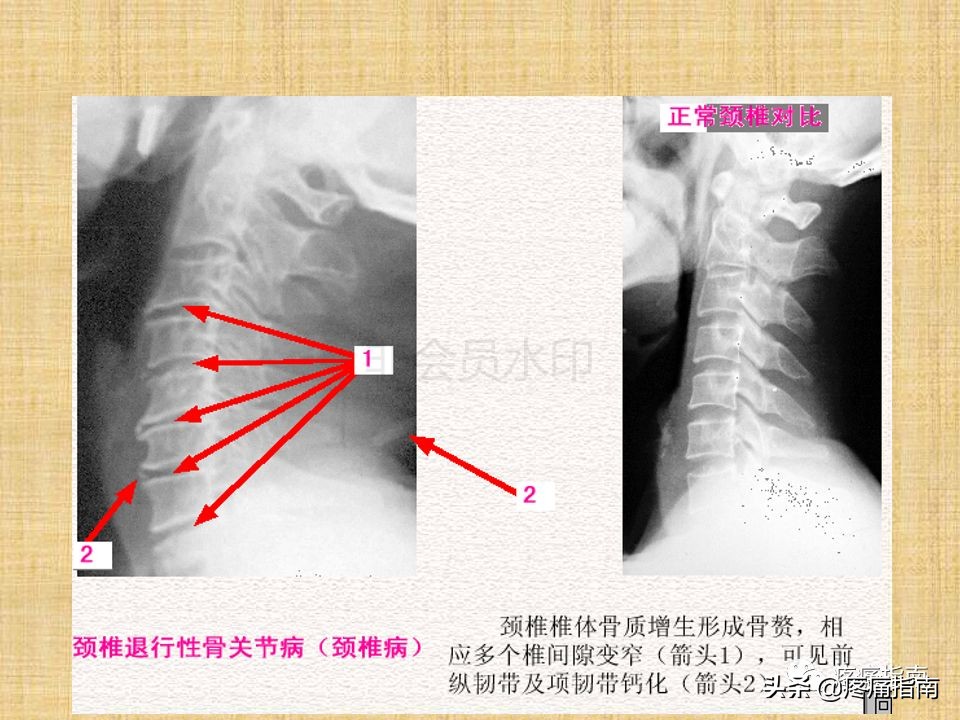 中医针灸推拿学入门,真正厉害的中医推拿