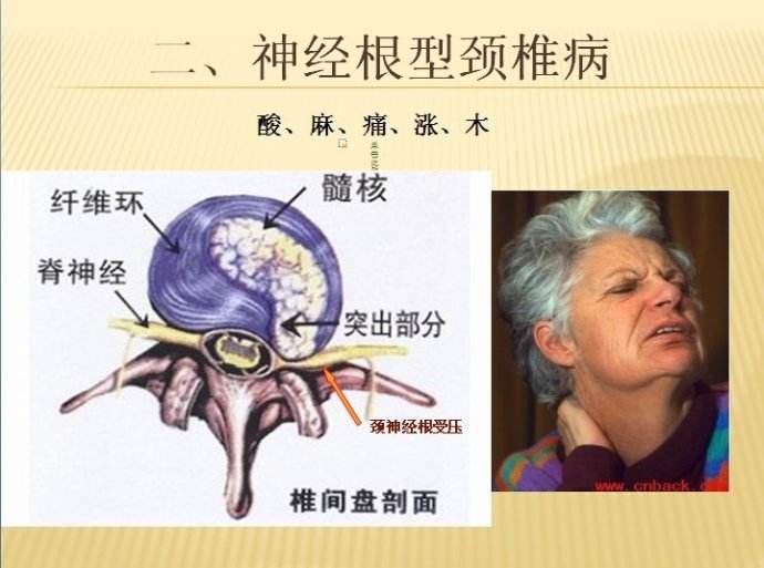 左肩膀痛如何区别肩周炎或颈椎病,肩膀疼不是肩周炎肯定是癌症吗