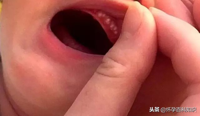 新生儿30个常见问题及处理技巧,新生儿一个月常见问题