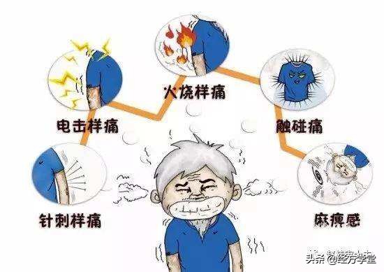 带状疱疹后遗神经痛特效药,带状疱疹后遗神经痛看中西医