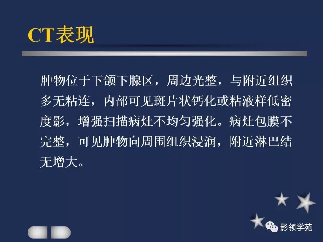 腮腺疾病影像学诊断,腮腺肿块影像诊断