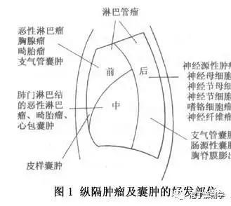 纵隔人体解剖学,纵隔解剖x线表现