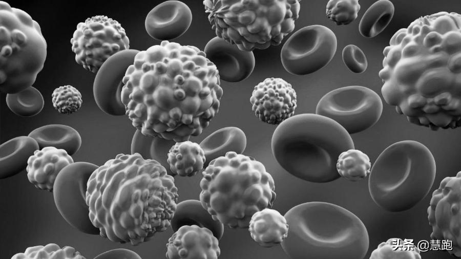 肺癌晚期跑步真实案例,肺癌晚期病人需要锻炼跑步