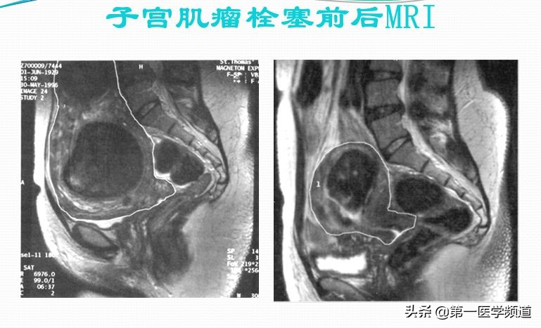 「医影传声」上海交通大学医学院附属瑞金医院卢湾分院放射科主任