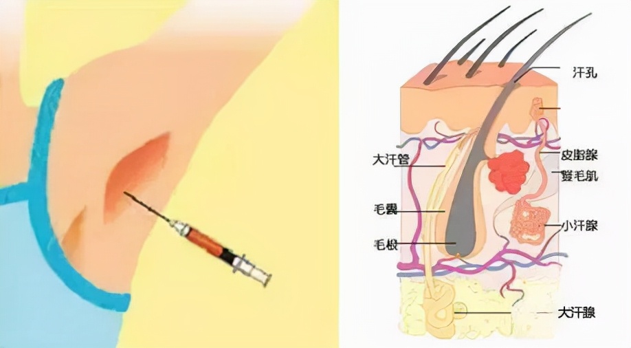 最让多汗人士尴尬的问题，一篇全解决
