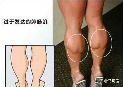 小腿粗怎么判断是脂肪还是肌肉,坐着快速瘦脂肪小腿的正确方法