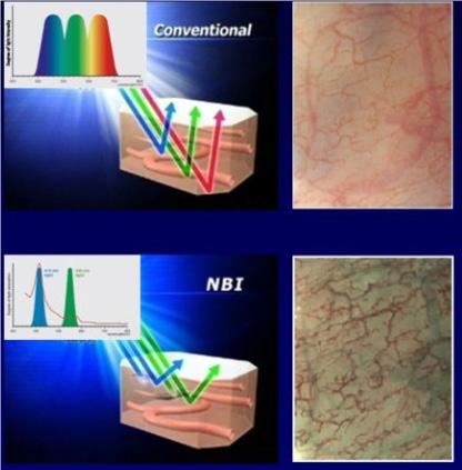 肿瘤防治知识资料,肿瘤科普与指南