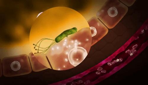 感染幽门螺杆菌吃什么食物,幽门螺杆菌感染2种食物建议忌口