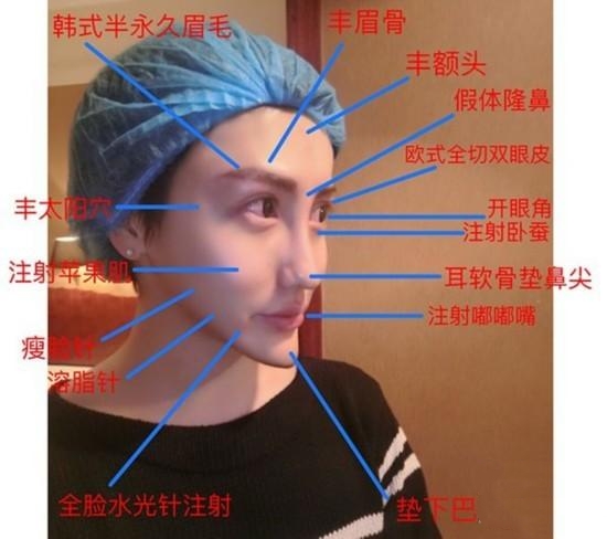 不用整形也可以变美吗,想变美做哪些手术