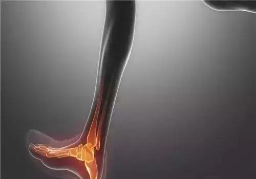 很多人崴了脚不知道该怎么办,那些崴脚后的人现在怎么样了