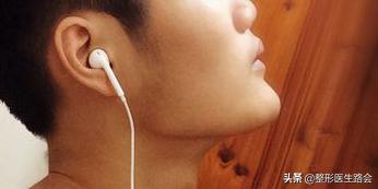 面中部凹陷下巴微翘,朱元璋式下巴怎么矫正