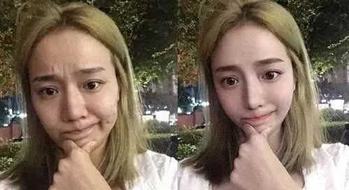 怎么去黑头最有效教你5个小妙招,怎么去黑头最有效最方便的方法