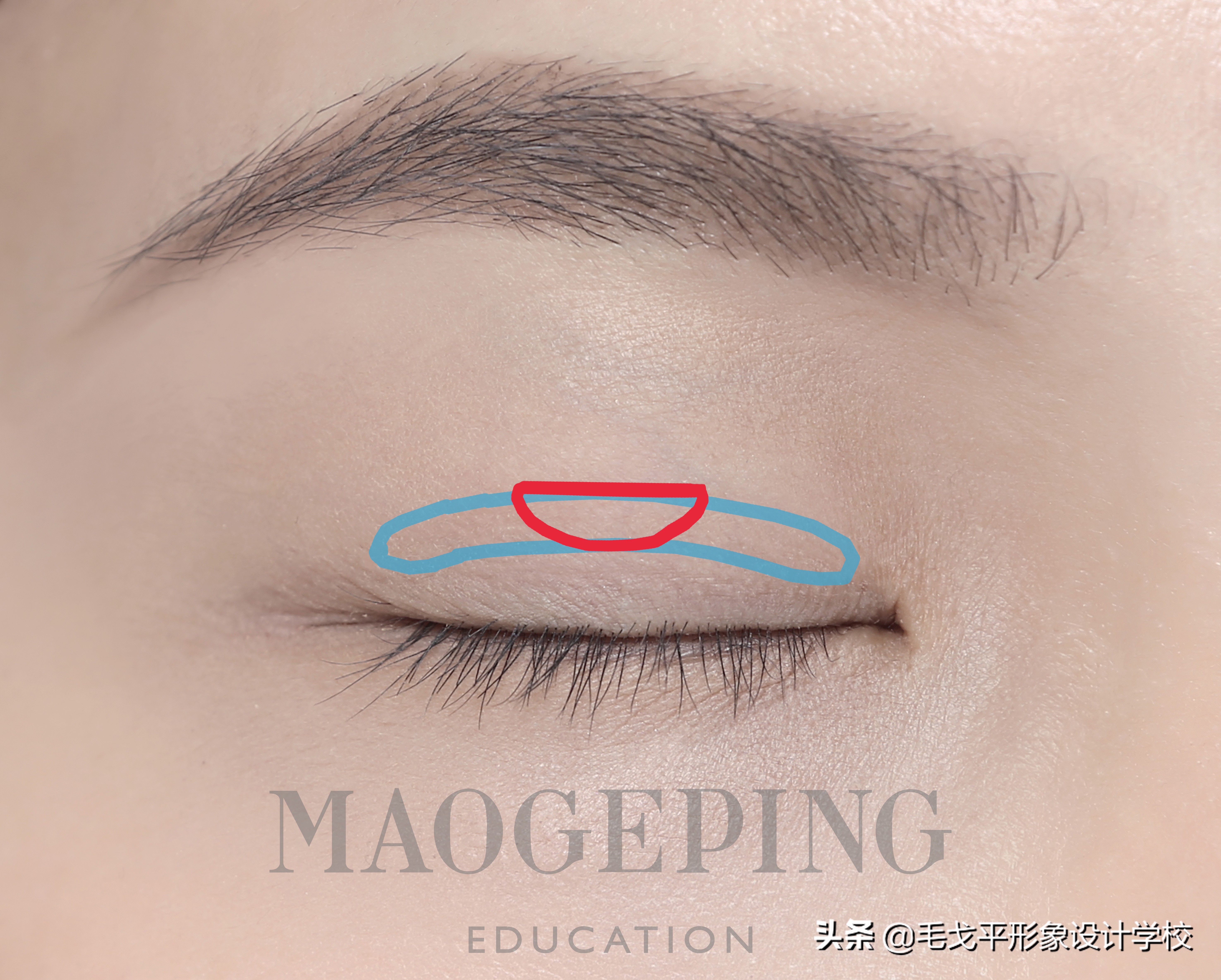 单眼皮肿眼泡正确贴法教程,单眼皮肿眼泡怎么贴双眼皮