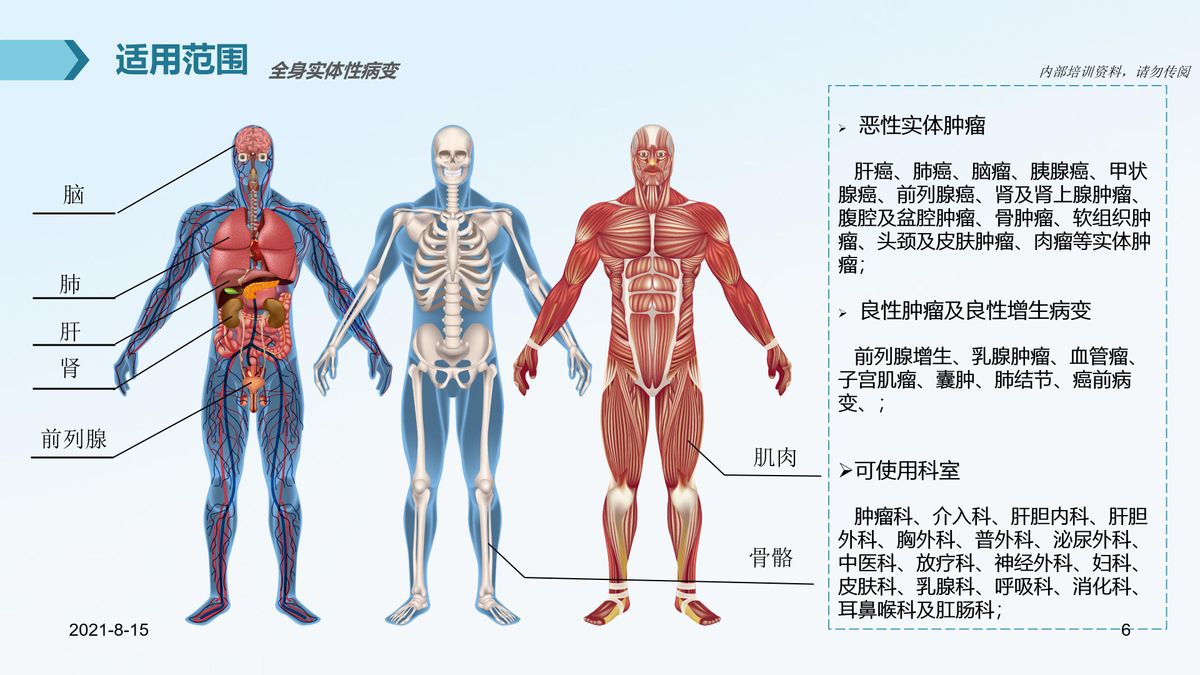 氩氦刀适合早期的肿瘤的切除么,氩氦刀肿瘤治疗新方法