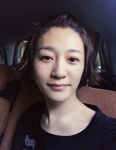 女生闭口粉刺怎么办,有闭口粉刺做什么医美