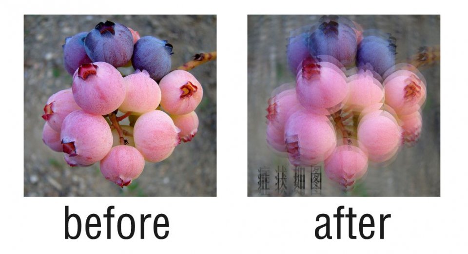 散光是什么意思和远视怎么区分,近视散光与散光的区别