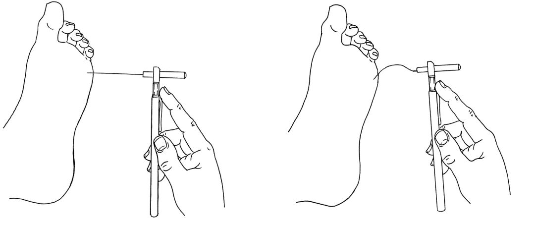 预防糖尿病足发生的正确方法,足部健康养生一切从脚开始